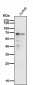 Anti-Estrogen Receptor alpha Rabbit Monoclonal Antibody